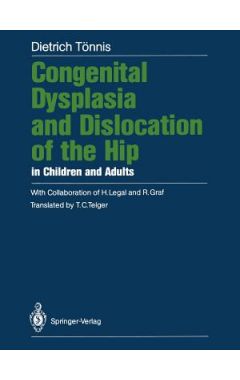 Congenital Dysplasia and Dislocation of the Hip in Children and Adults