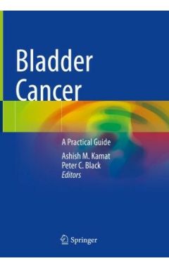 Bladder Cancer: A Practical Guide