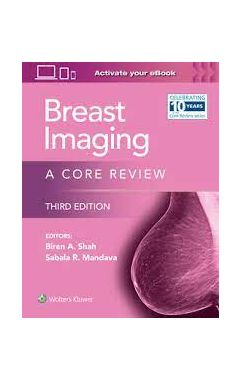 Breast Imaging: A Core Review