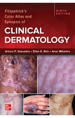 Ie Fitzpatrick's Color Atlas And Synopsis Of Clinical Dermatology 9e ie