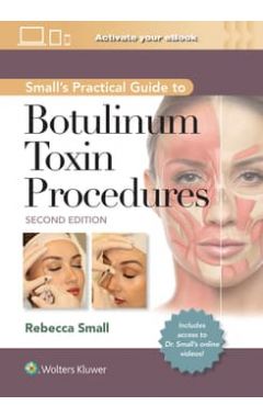 Small's Practical Guide to Botulinum Toxin Procedures: Print + eBook with Multimedia