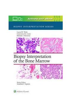 Biopsy Interpretation of the Bone Marrow